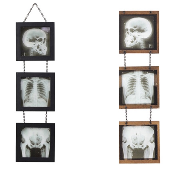 X-Ray Skeleton Wall Decor 18” - Picture 1 of 4